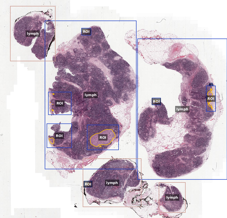 Annotated whole-slide histopathology image with labeled tissue regions